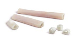 allograft about