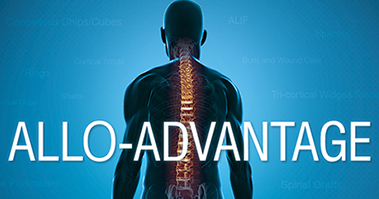 Allo-Advantage